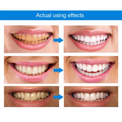 Teeth Whitening Pen